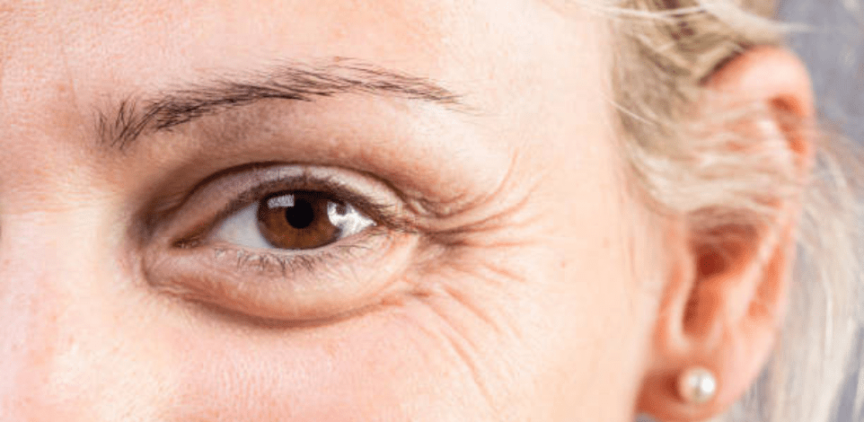 get rid of wrinkles